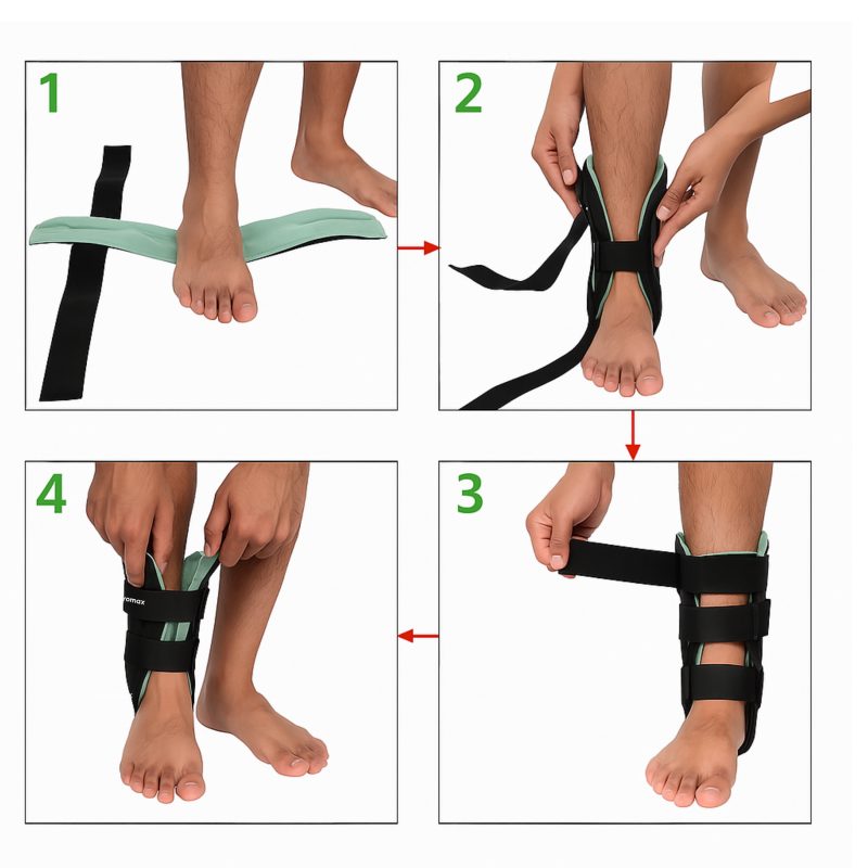 Ankle Splint - Image 3
